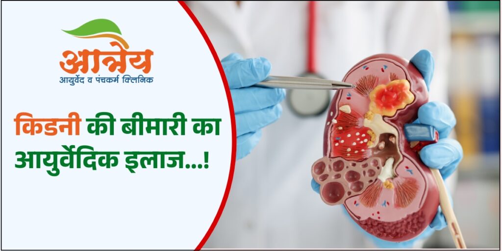 ayurvedic treatment for kidney disease