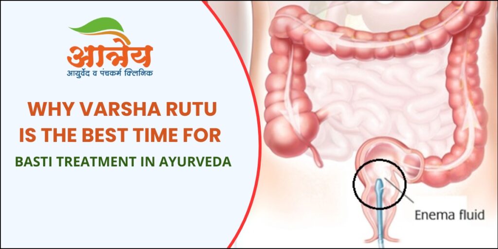 Basti Treatment in Ayurveda