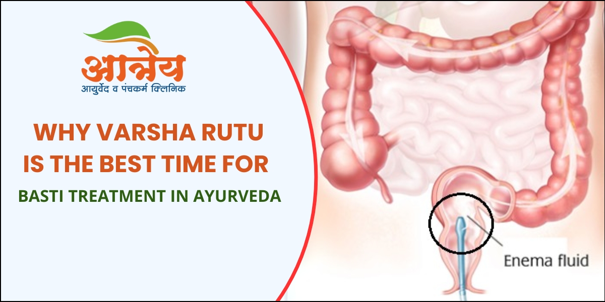 Basti Treatment in Ayurveda