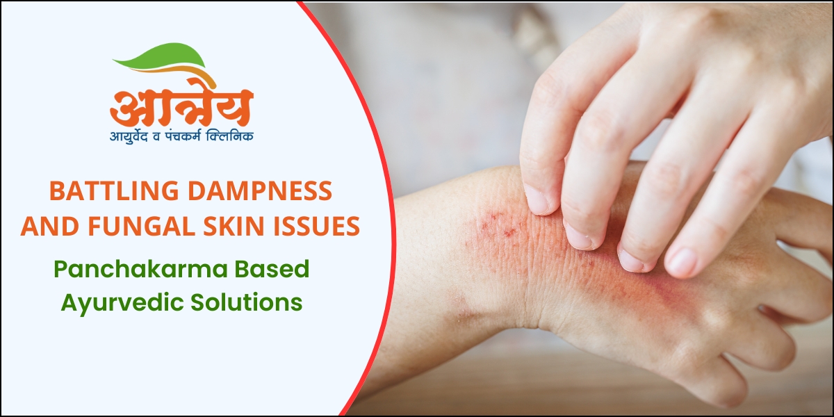 Fungal Skin infection