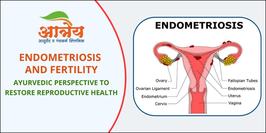 Endometriosis & Fertility