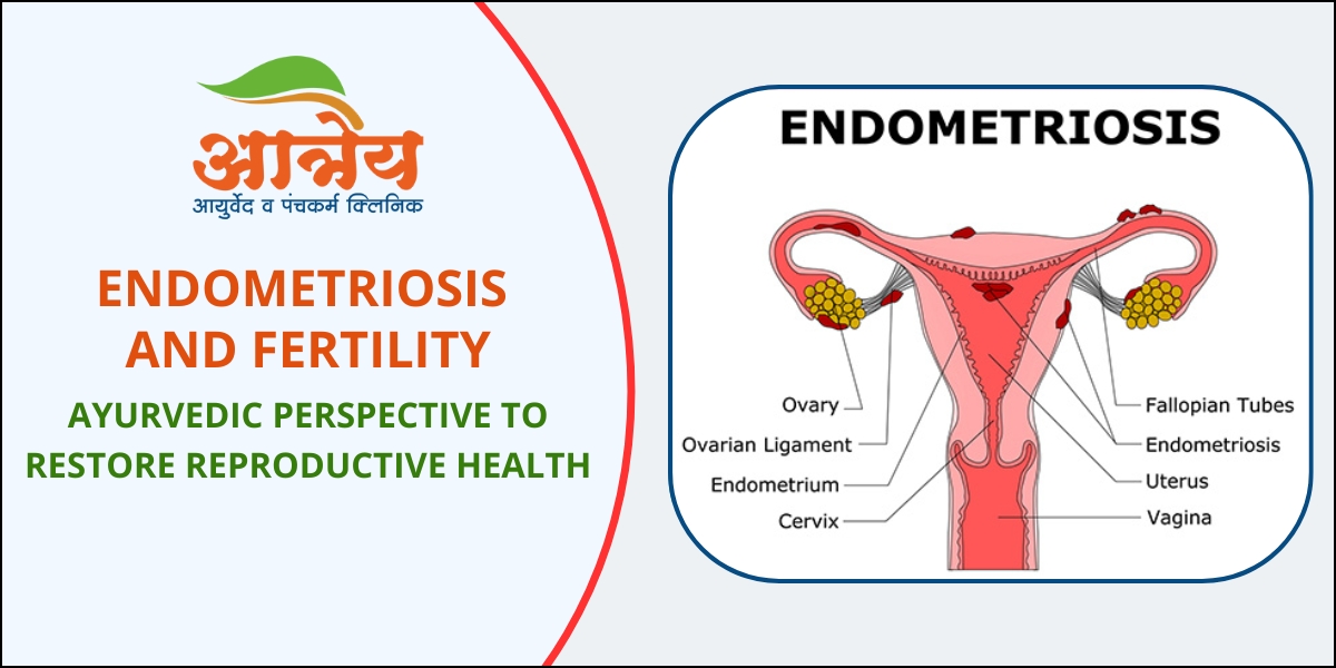 Endometriosis & Fertility
